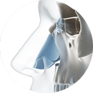 345 Plastic Surgery diagram of nasal structure where natural rhinoplasty is performed