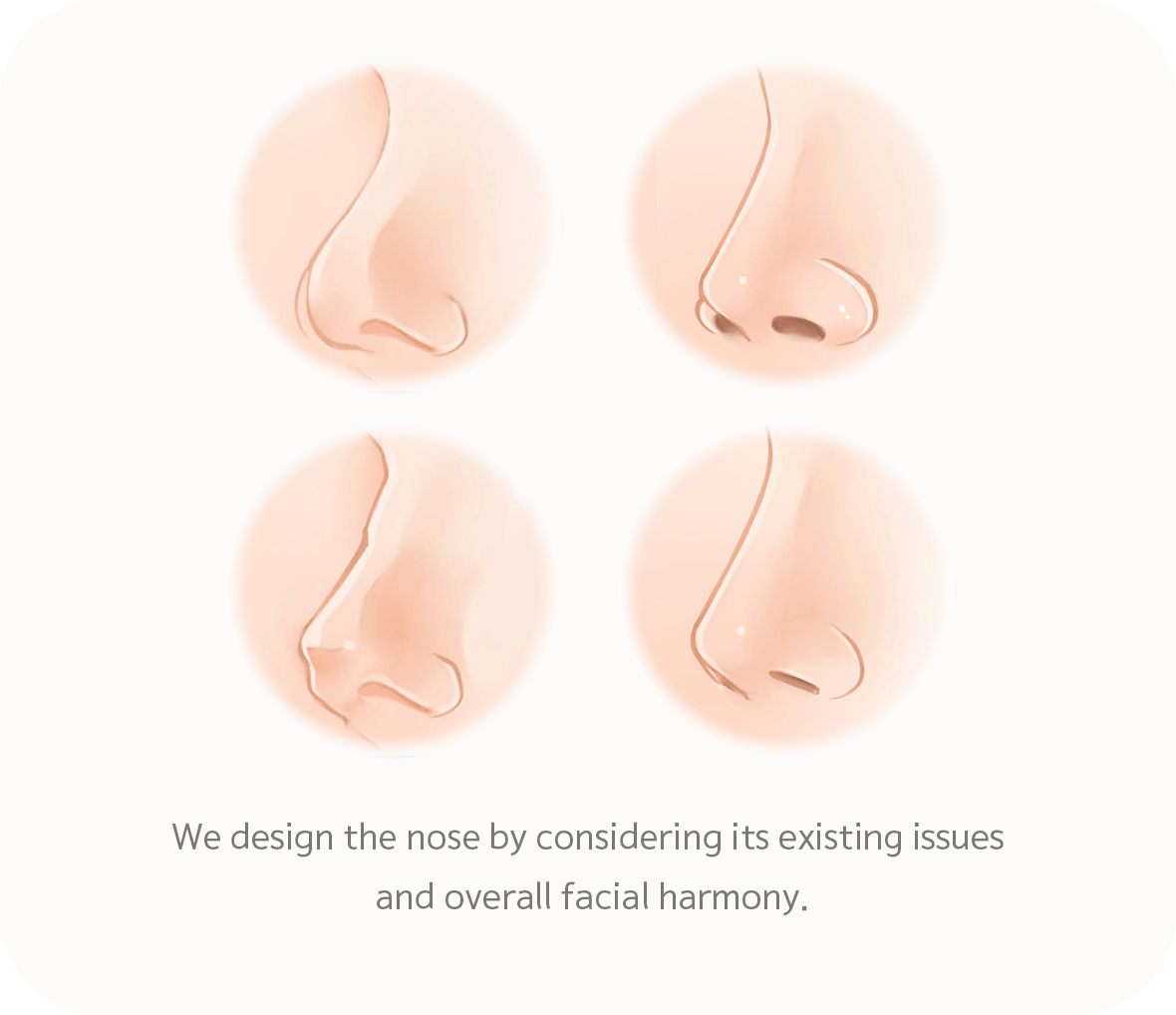 Four nose shapes for 345 plastic surgery where natural rhinoplasty options.