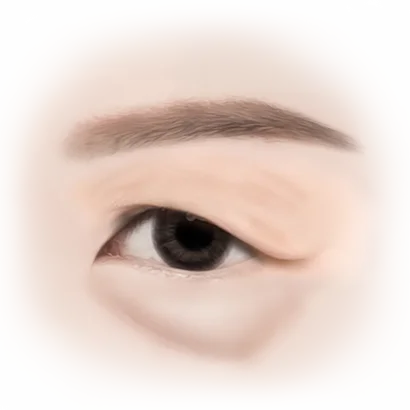 Close-up of an eye showing results of 345 plastic surgery where natural