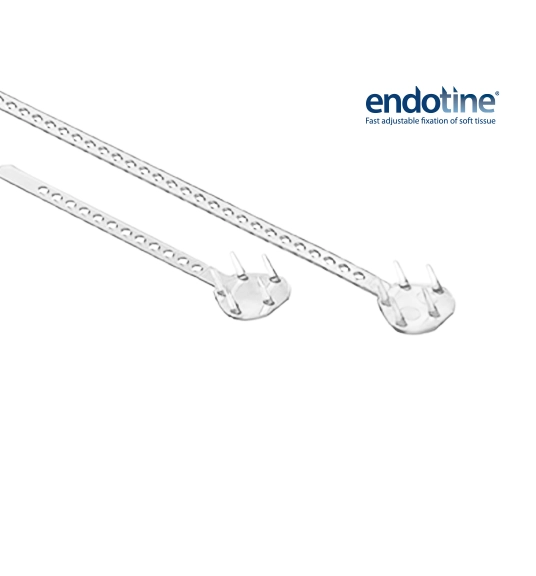 Endotine plastic surgery device for 345 plastic surgery where natural.
