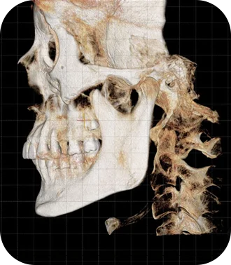 3D CT scan of skull and spine for plastic surgery where natural. 345 Plastic Surgery.