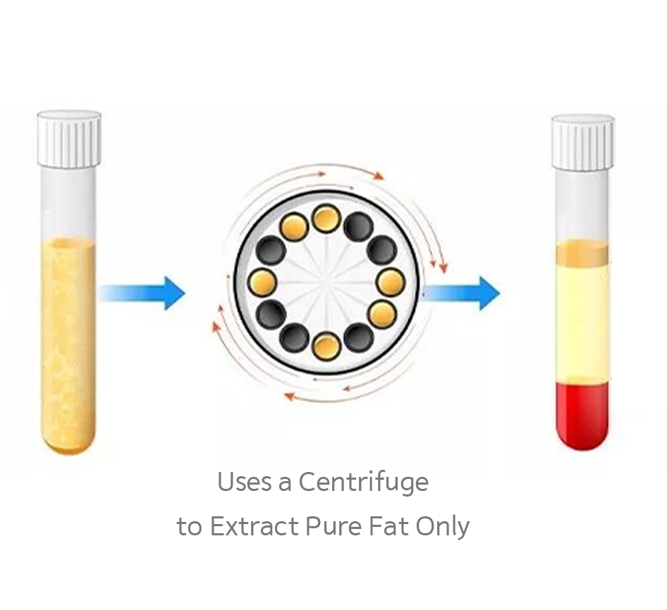 345 Plastic Surgery centrifuge separates fat for natural results. Plastic surgery where natural.