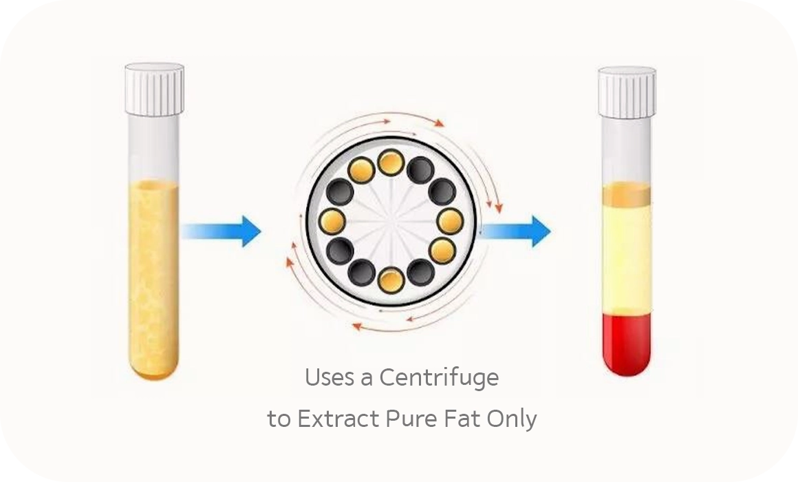 345 Plastic Surgery: Centrifuge extracts pure fat for natural plastic surgery.