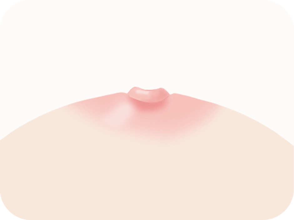 Illustration of a nipple after 345 plastic surgery where natural.