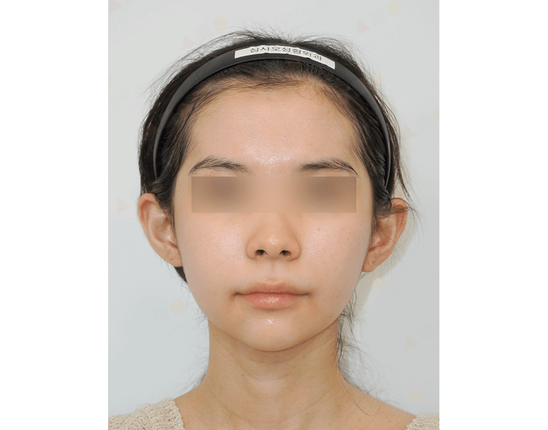 Person with headband and blurred eyes facing forward.