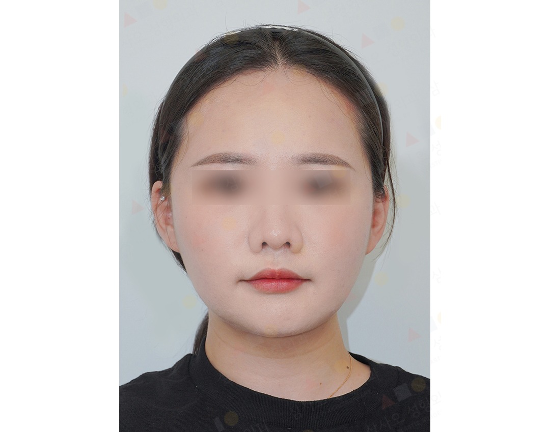 Portrait of a person with blurred eyes.