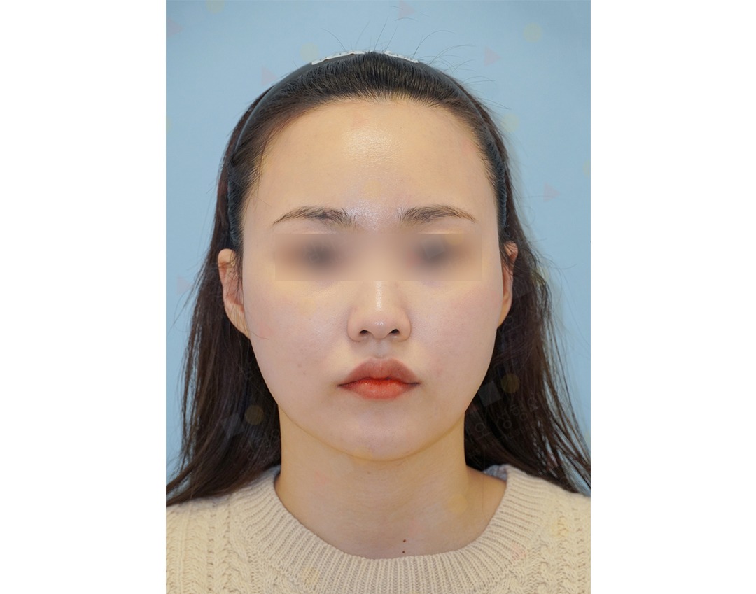 Woman with neutral expression, blurred eyes.