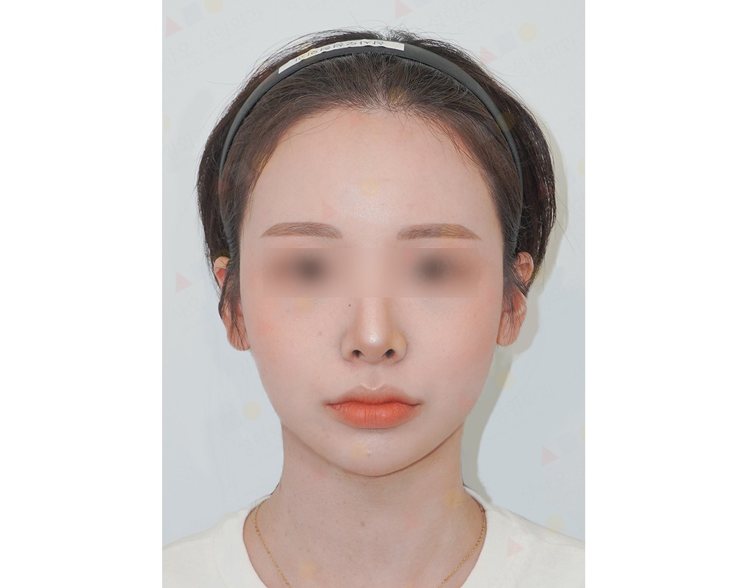 Woman with headband facing forward.