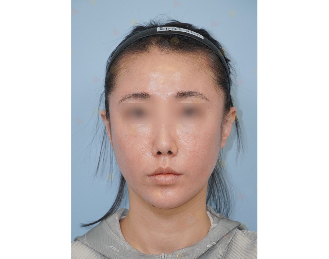 Person with headband looking forward, neutral expression.