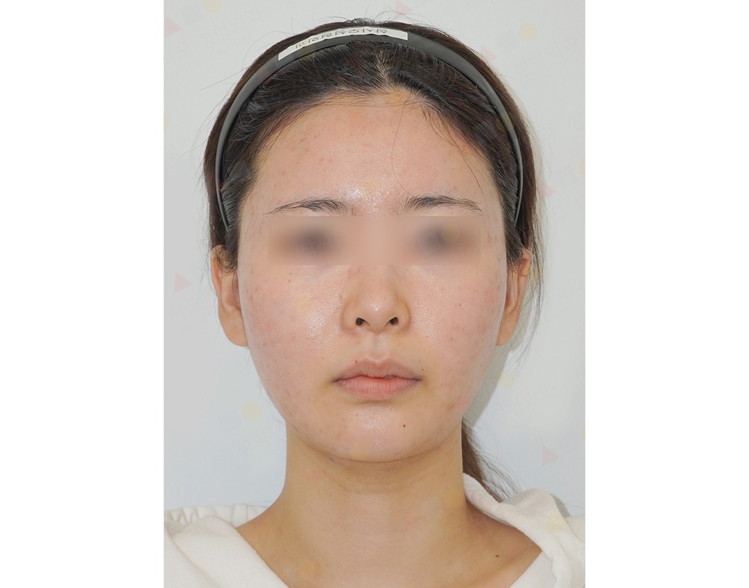 Person with blurred eyes wearing a headband.