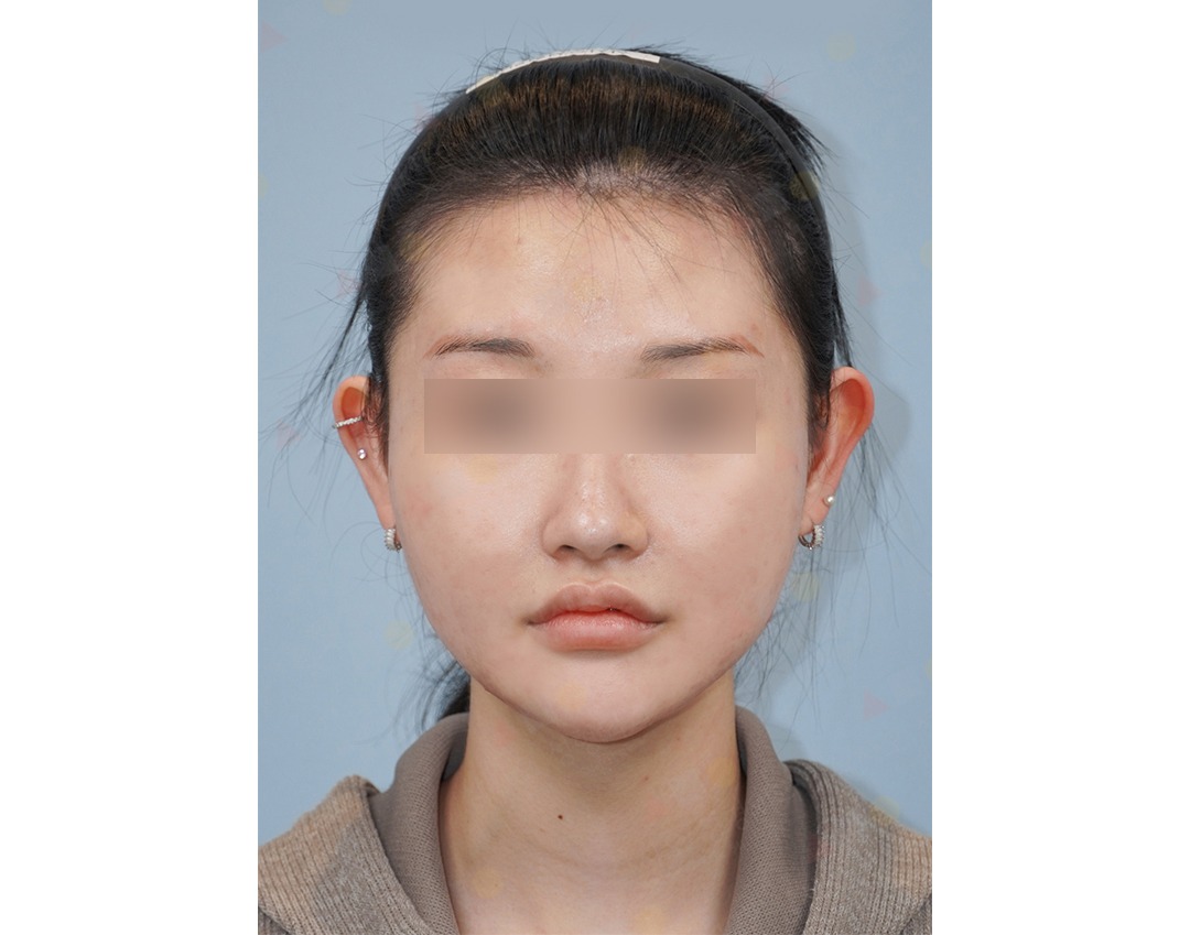 Woman with blurred eyes, headband, and earrings.