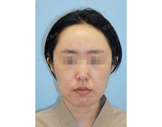 Person with blurred eyes against blue background.