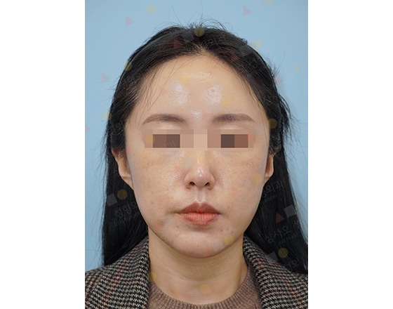 Close-up of woman's face with blurred eyes