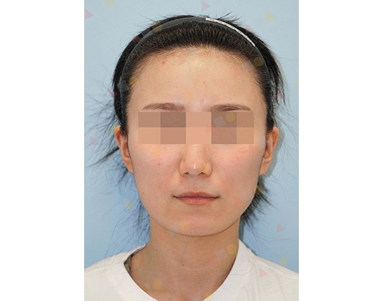 Woman with mosaic over eyes, wearing headband