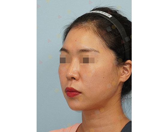 Woman with headband and blurred eyes