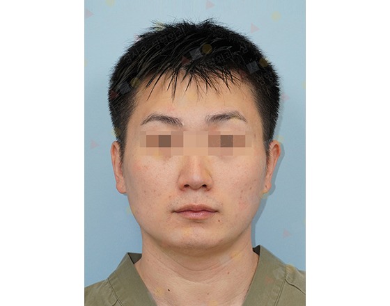 Person with pixelated eyes against blue background