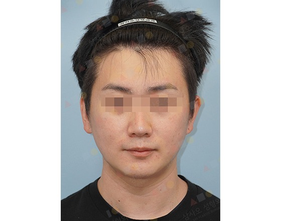 Person with headband, pixelated face, neutral expression.