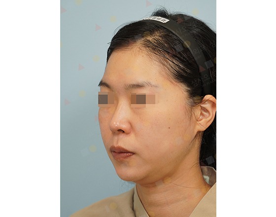 Woman with headband, blurred eyes, neutral expression.