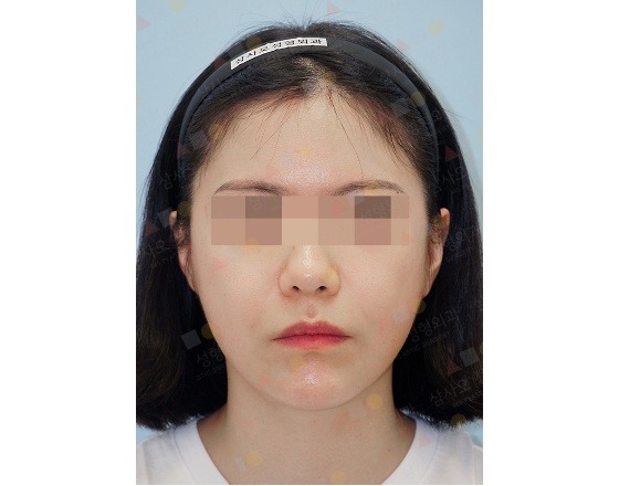 Neutral expression, woman with headband, blurred eyes