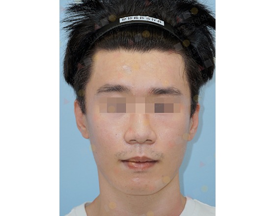 Person with hairband, pixelated eyes, neutral expression