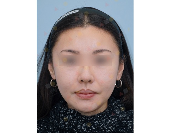 Woman with blurred eyes in a headband.