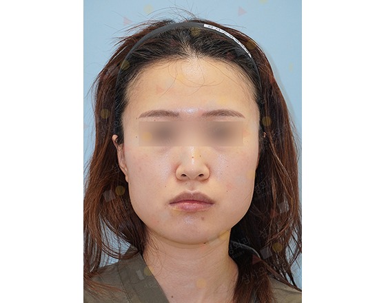 Woman with headband facing forward