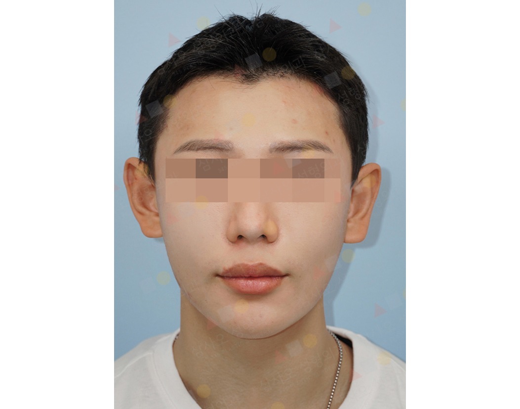 Close-up of person with pixelated eyes.