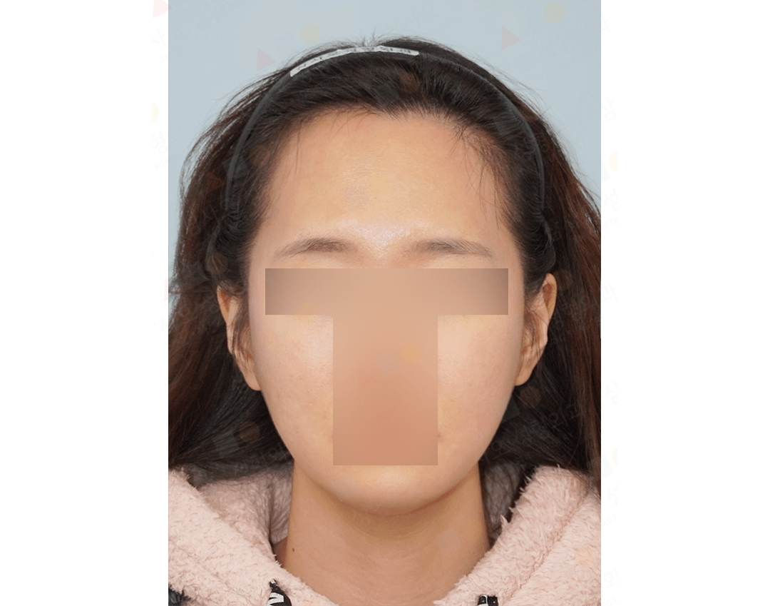 Portrait of person with pixelated face, wearing headband.