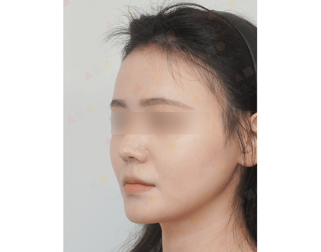 Profile of person wearing headband, side view.