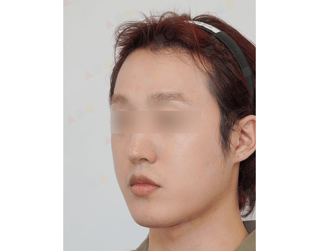 Portrait of a person with headband, side view.