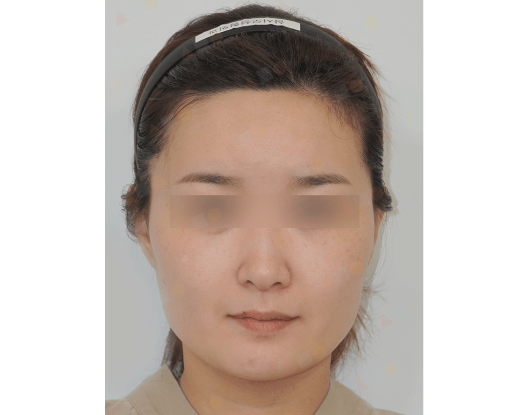 Person with headband and neutral expression