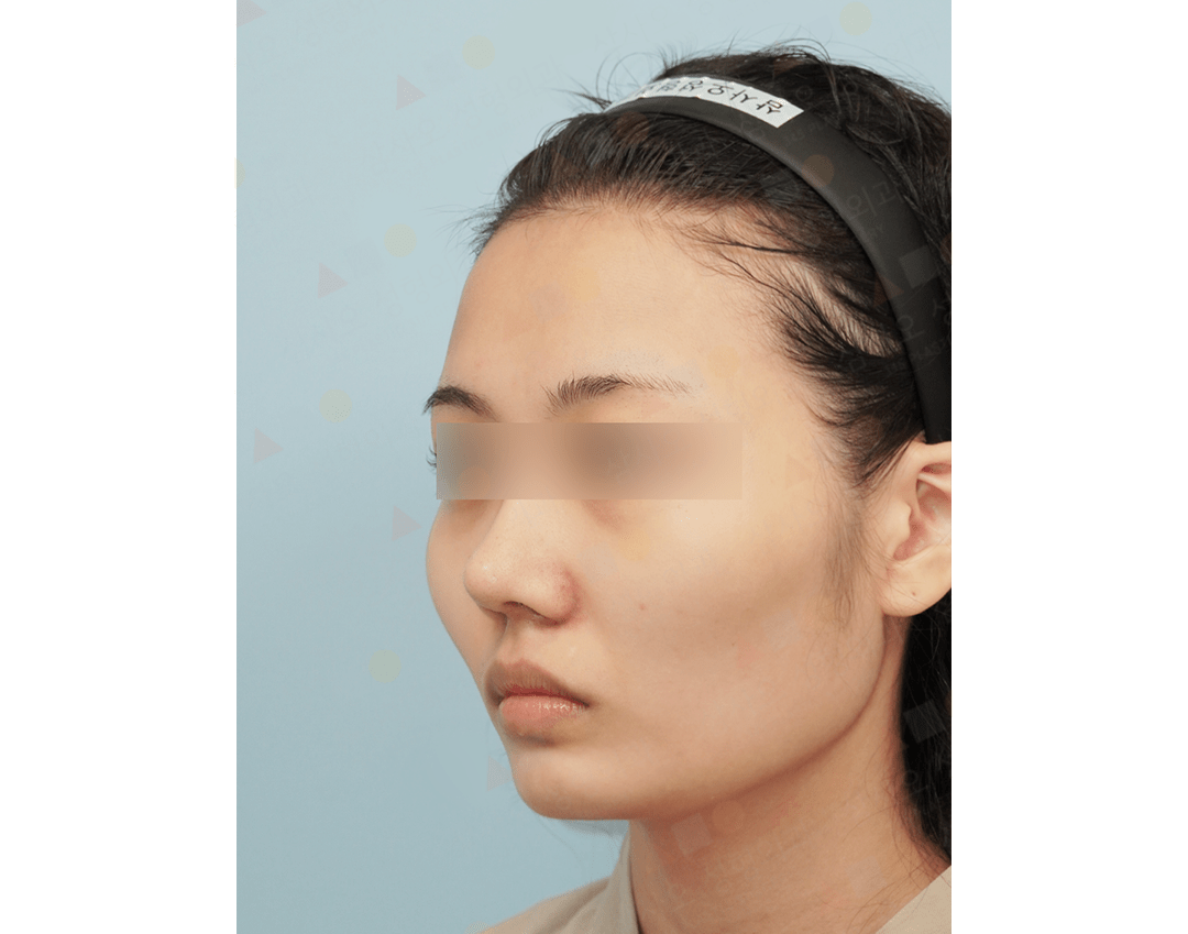 Profile view of person with headband