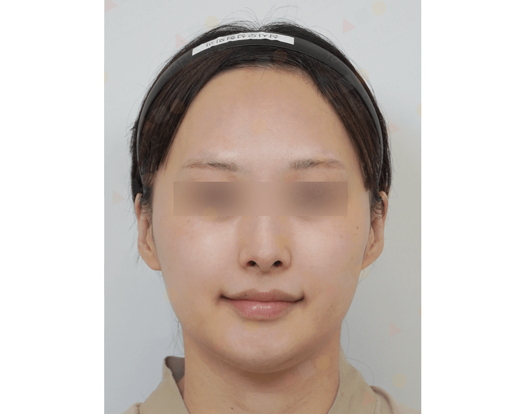 Portrait of person with headband and blurred eyes.