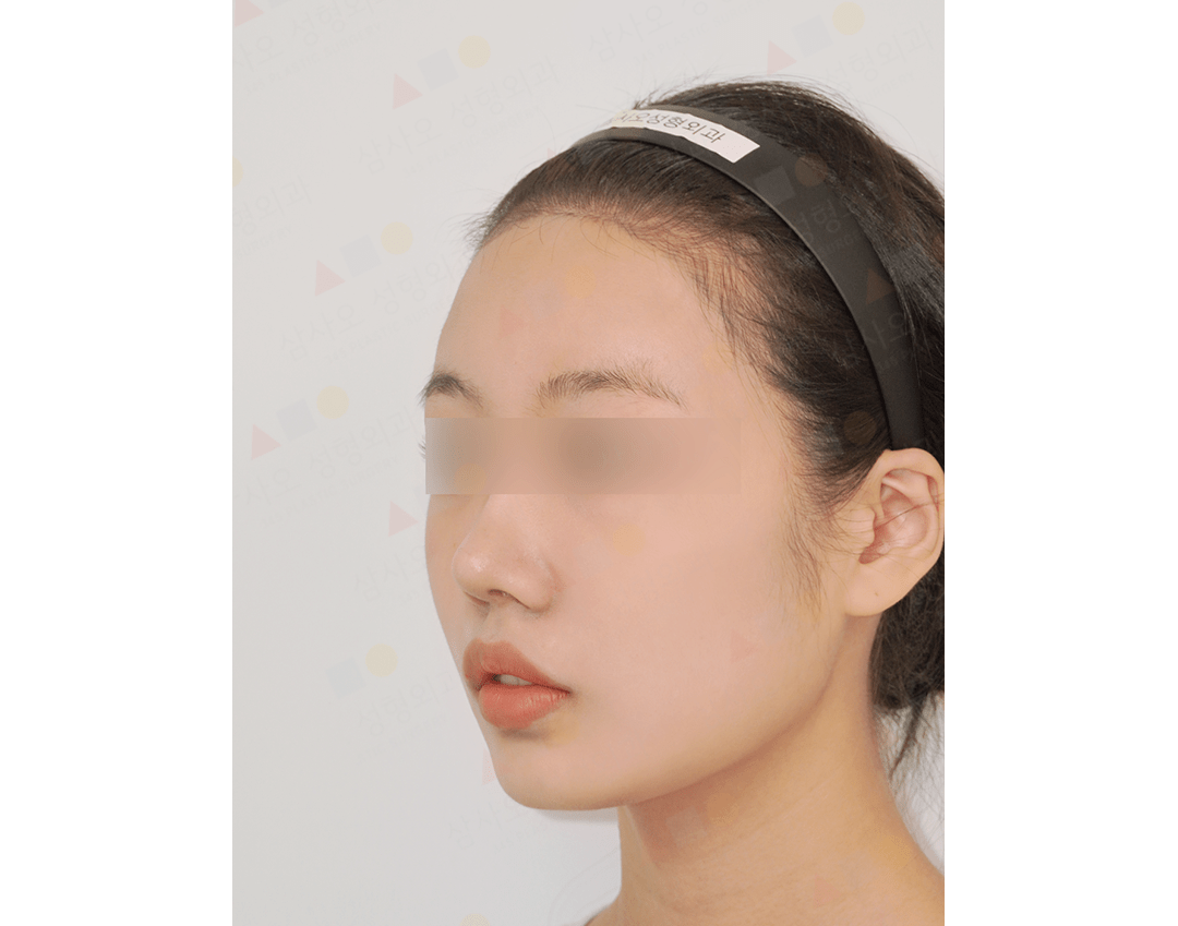 Person with headband, side profile view