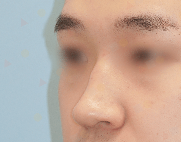 Close-up of person's nose and blurred eyes