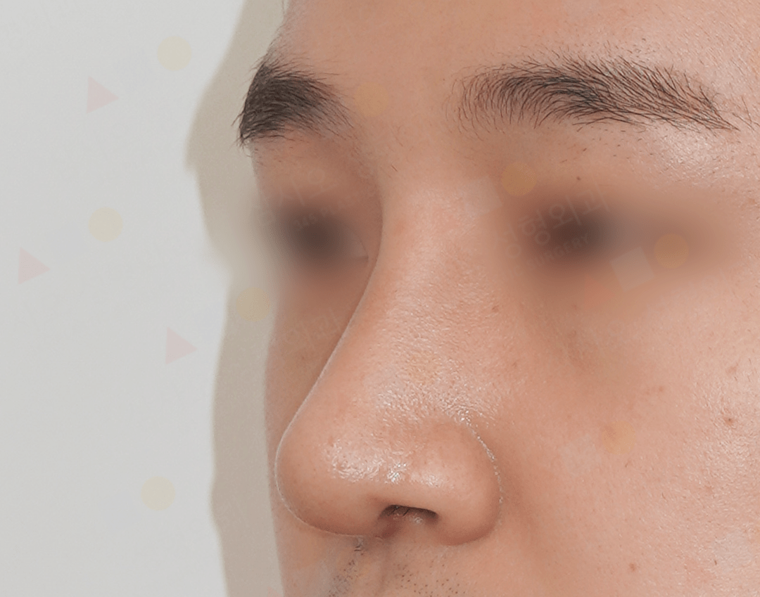 Close-up of a person's nose and complexion