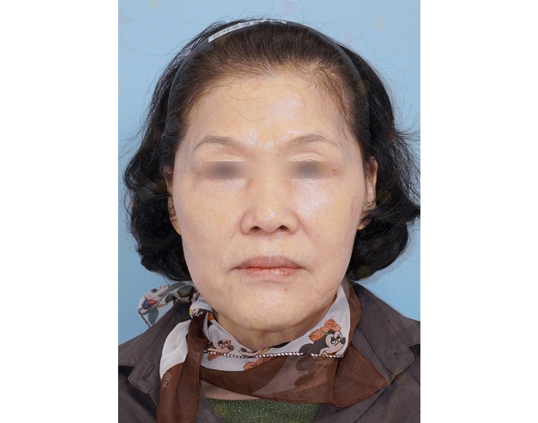 Portrait of a person with blurred eyes.