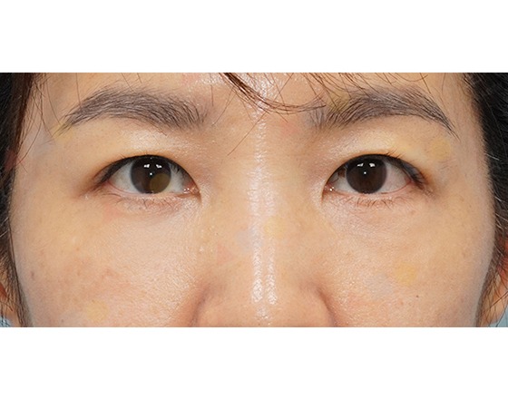 Close-up of person's eyes and eyebrows.