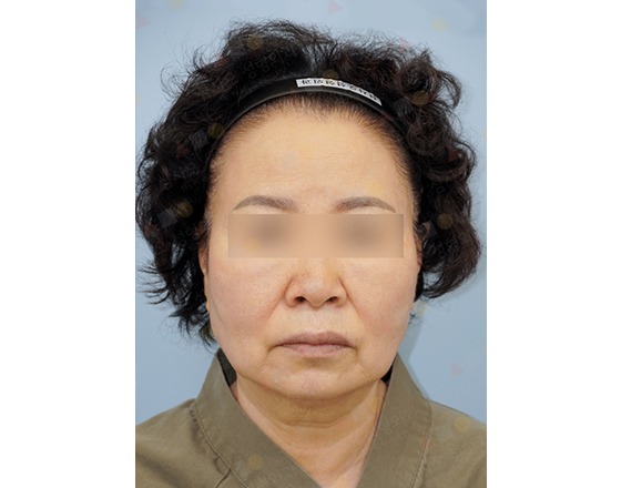 Portrait of a person with blurred eyes.