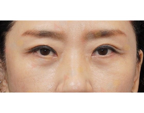 Close-up of woman's eyes with minimal makeup.