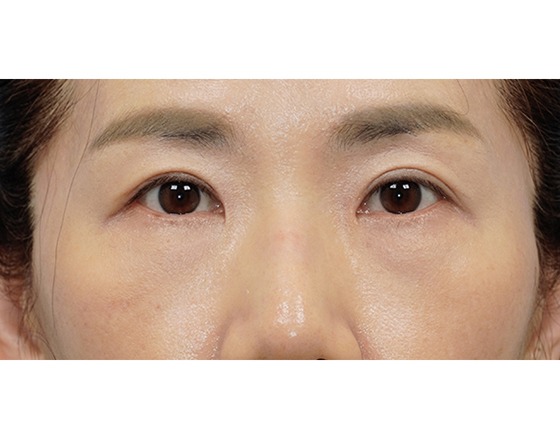 Close-up of a person's eyes and eyebrows