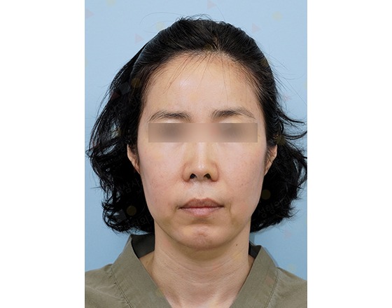 Woman with closed eyes in neutral expression.