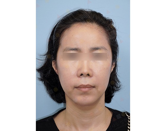 Person with short hair and neutral expression.