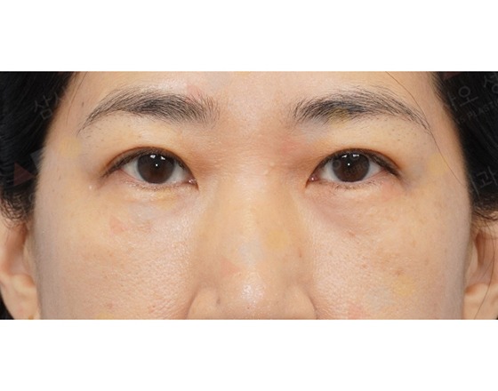 Close-up of a person's eyes and eyebrows.