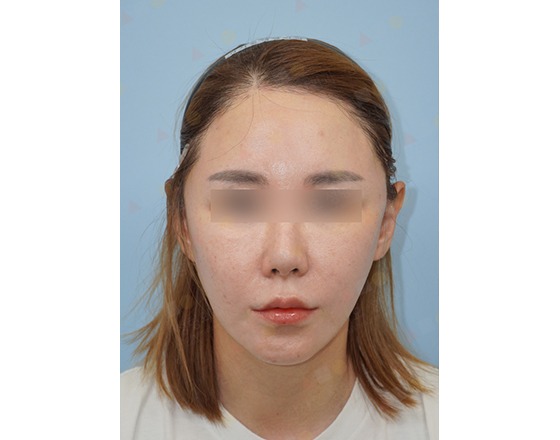 Front view of a person's face