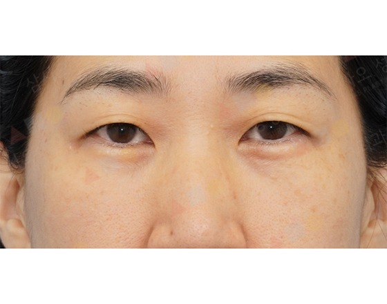 Close-up of person's eyes and eyebrows.