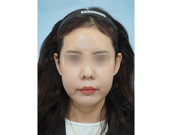 Woman with headband and blurred eyes on photo