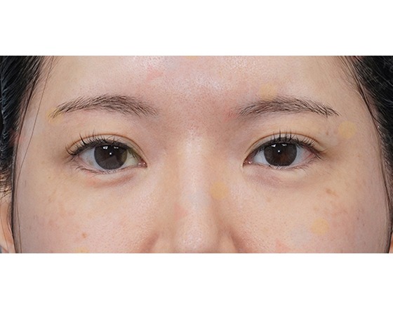 Close-up of person's face and eyes.