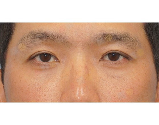 Close-up of a person's eyes and eyebrows.