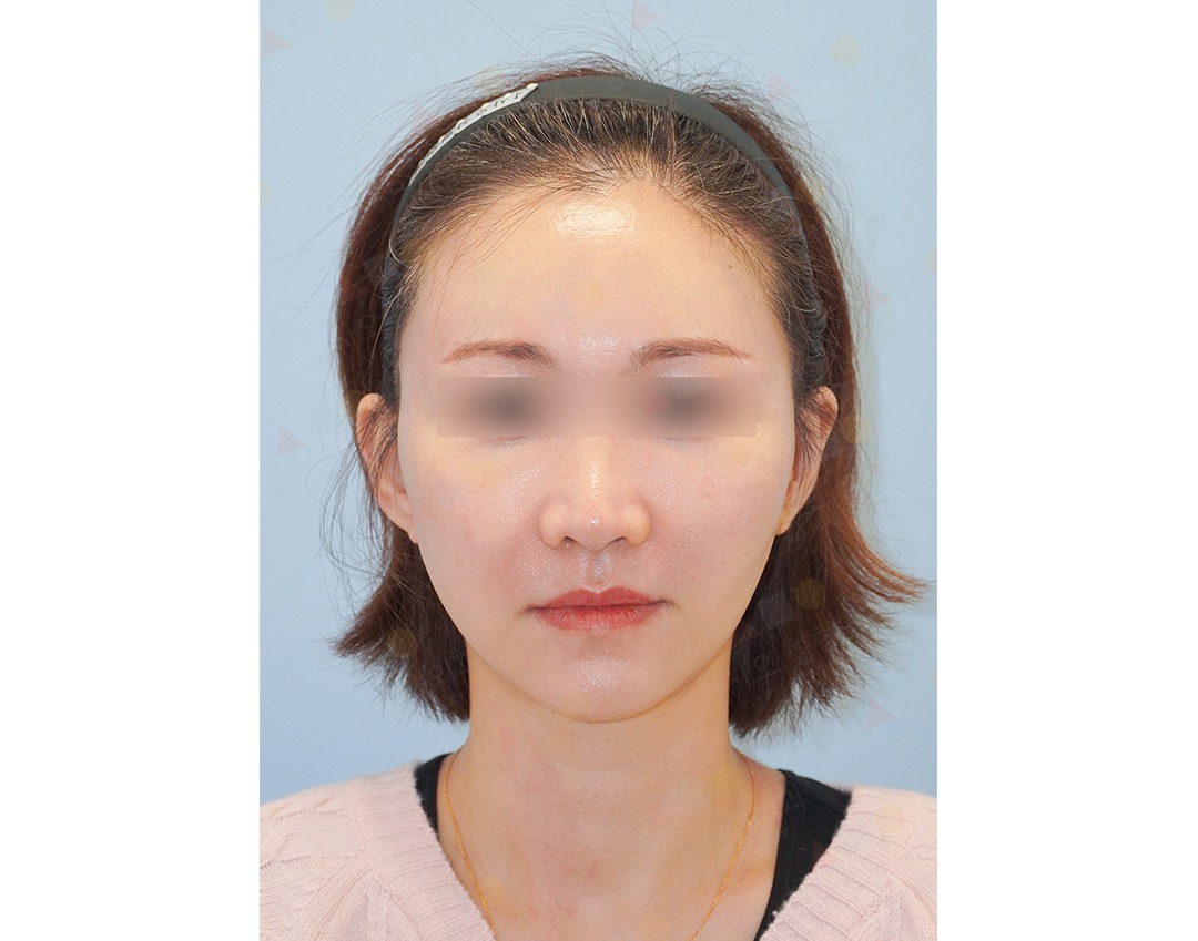 Woman with blurred eyes, headband, neutral expression